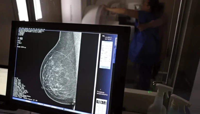 Ministério da Saúde passa a recomendar mamografia a partir dos 40 anos
