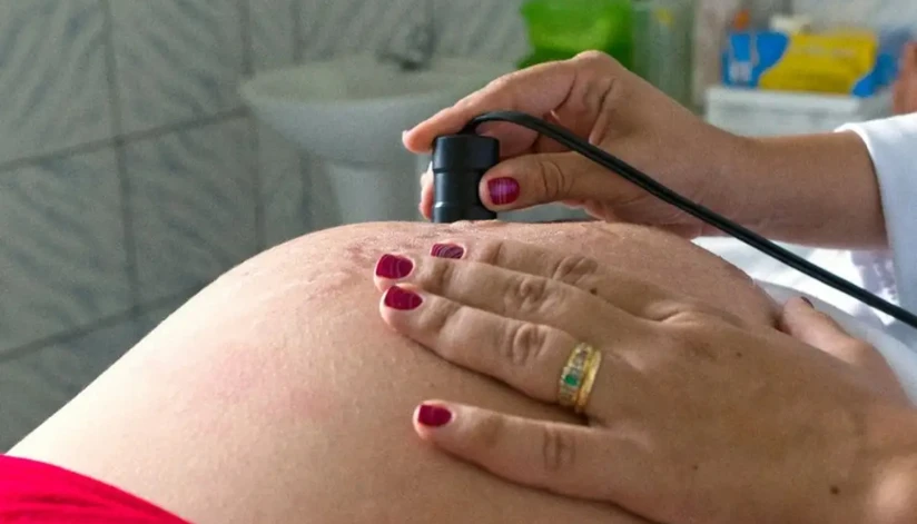 Pré-natal reduz chances de bebê nascer com anomalia, informa estudo da Fiocruz